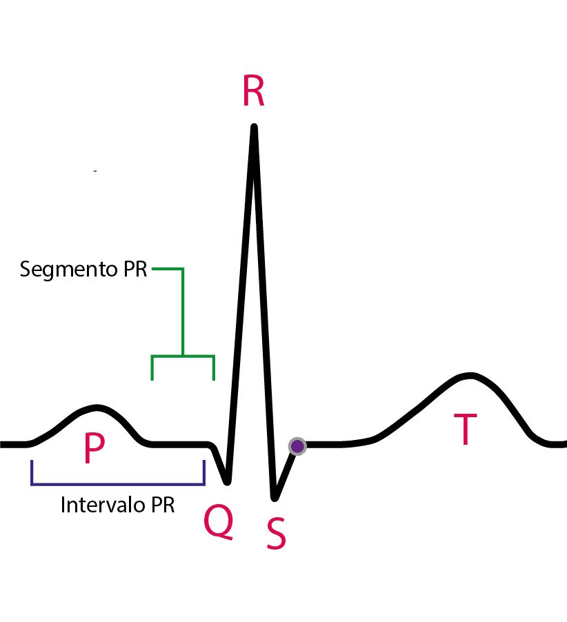 Representação do intervalo PR e do segmento PR no eletrocardiograma