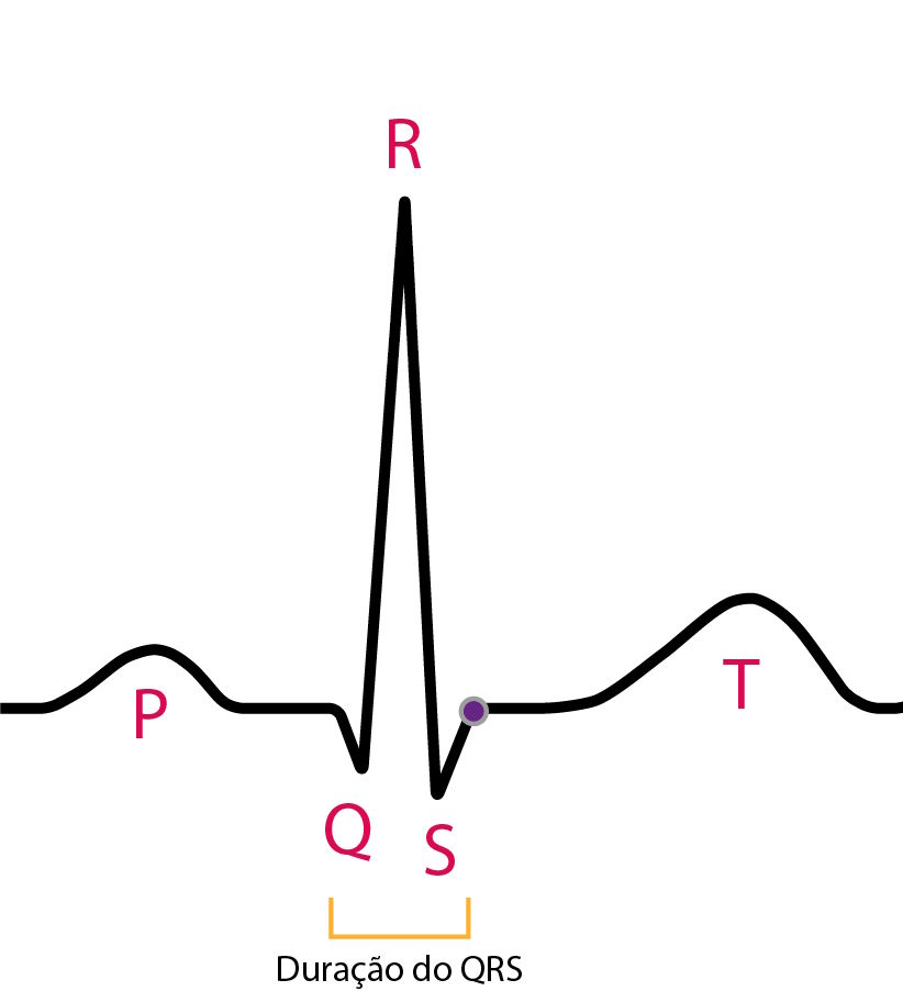 Representação do complexo QRS no eletrocardiograma