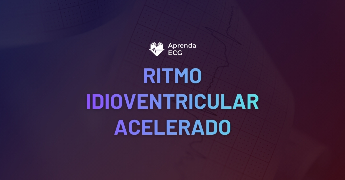 Ritmo Riva Ritmo Idioventricular Acelerado - Aprenda ECG | Doctor Quest